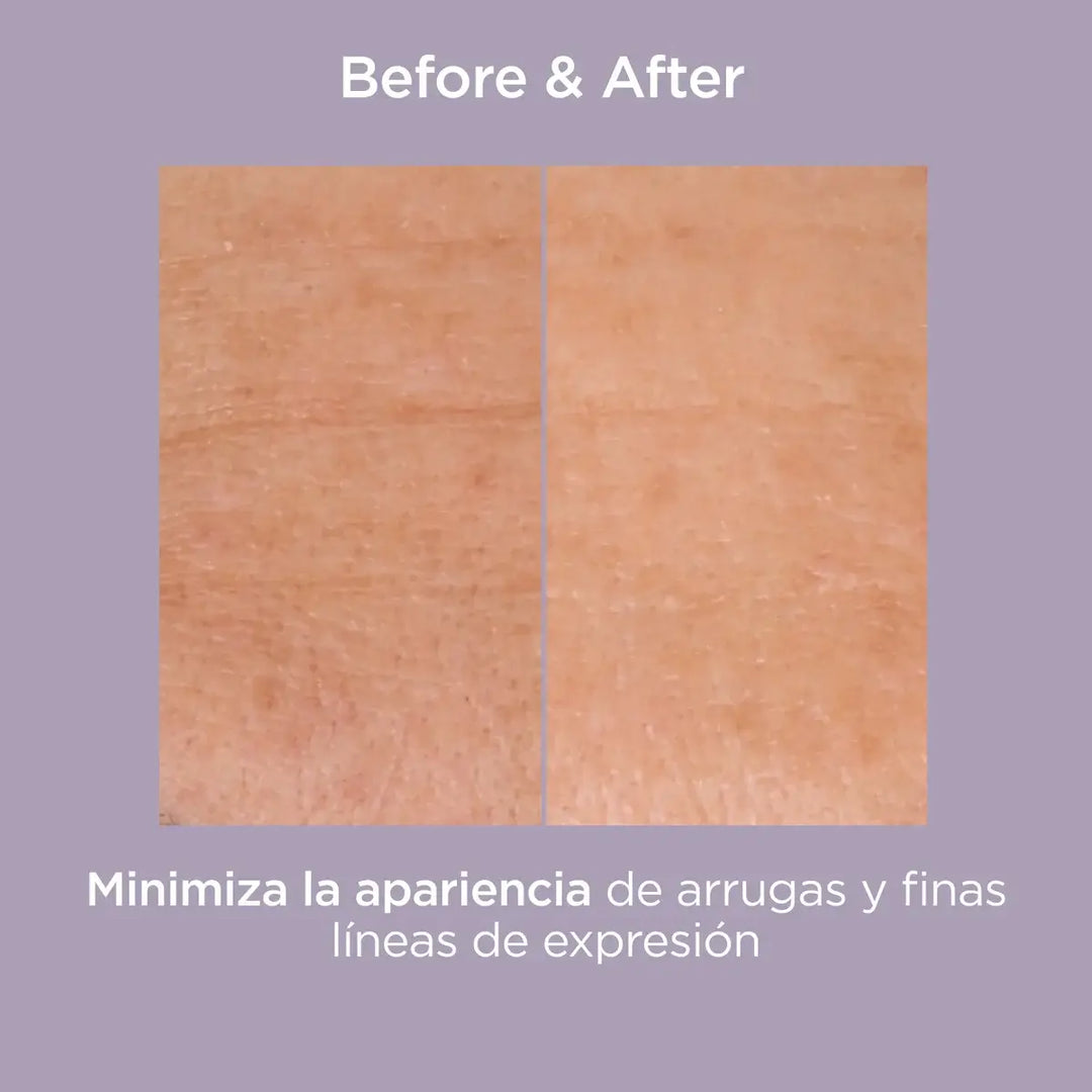 Glicoisdin 25 Intense