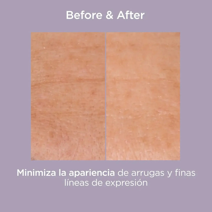 Glicoisdin 25 Intense